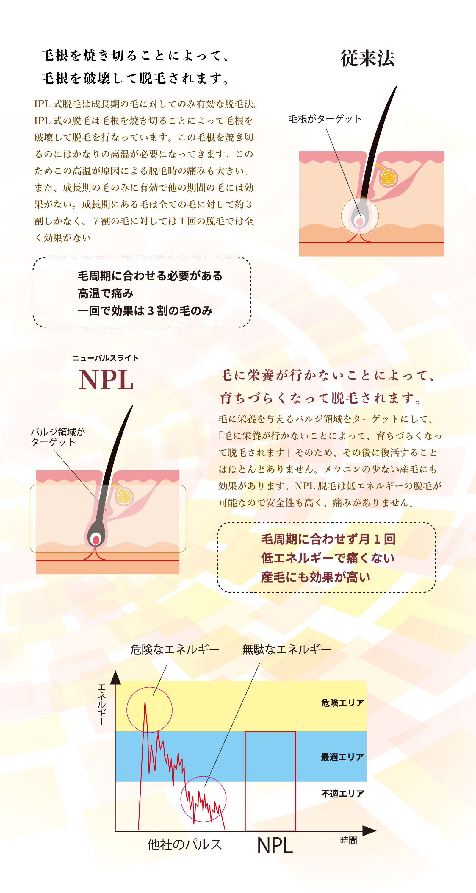 NPL脱毛について